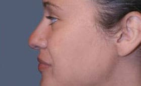 Dr. Dennis Gross Dermatology Before & After Pictures in New York, NY