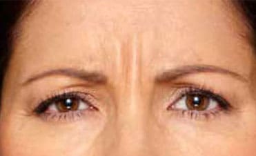 Dr. Dennis Gross Dermatology Before & After Pictures in New York, NY