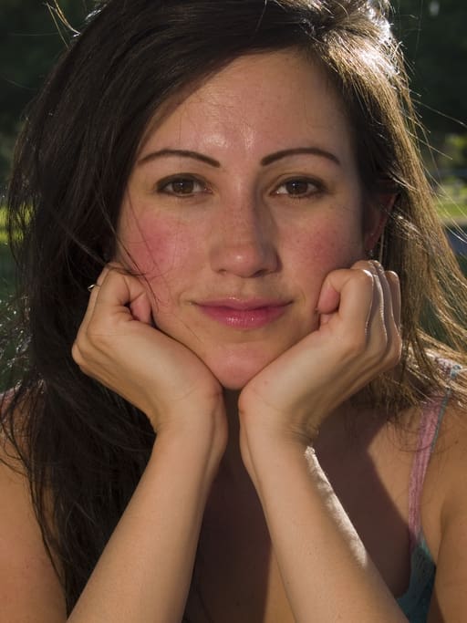 Rosacea Treatment in New York, NY