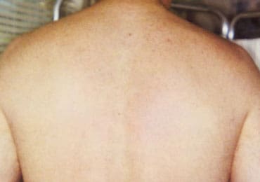 Dr. Dennis Gross Dermatology Before & After Pictures in New York, NY