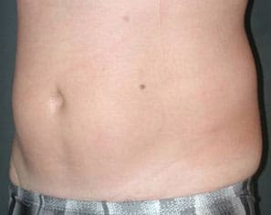 Dr. Dennis Gross Dermatology Before & After Pictures in New York, NY