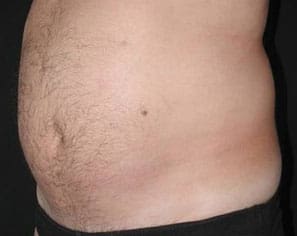 Dr. Dennis Gross Dermatology Before & After Pictures in New York, NY