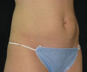 Dr. Dennis Gross Dermatology Before & After Pictures in New York, NY