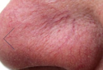 Dr. Dennis Gross Dermatology Before & After Pictures in New York, NY