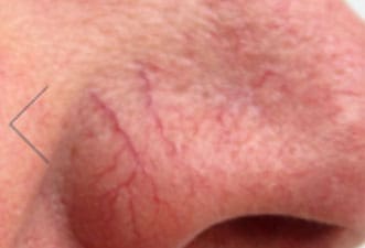 Dr. Dennis Gross Dermatology Before & After Pictures in New York, NY