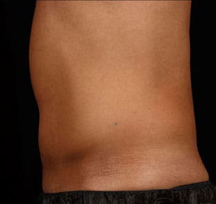 Dr. Dennis Gross Dermatology Before & After Pictures in New York, NY