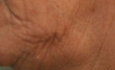 Dr. Dennis Gross Dermatology Before & After Pictures in New York, NY