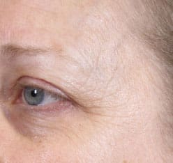 Dr. Dennis Gross Dermatology Before & After Pictures in New York, NY