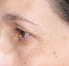 Dr. Dennis Gross Dermatology Before & After Pictures in New York, NY