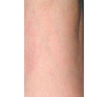 Dr. Dennis Gross Dermatology Before & After Pictures in New York, NY